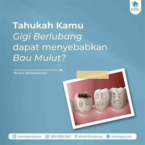 Gigi Berlubang Dapat Menyebabkan Bau Mulut Bfresh Dental Care