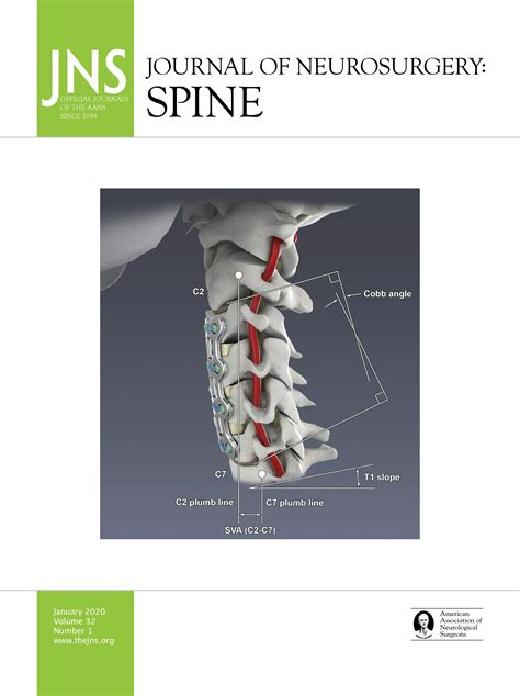 The Farmer And The Hunter A Longitudinal Philosophy Of Spine Surgery