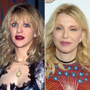 Celebrity Facelifts and Plastic Surgery: See Then-and-Now Pics | Life ...