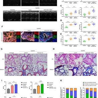 SIKs Inhibition Or Specific Smooth Muscle SIK1 Knockdown Aggravated PAH