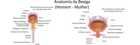 O Colo Da Bexiga É A Região Onde - Saiba Tudo Sobre a Reabilitação da Bexiga Hiperativa