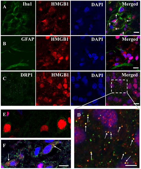 Cells Free Full Text HMGB1 Translocation In Neurons After Ischemic