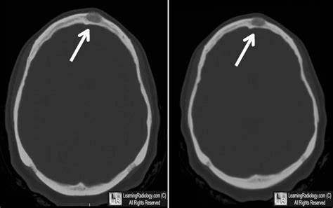 Learningradiology