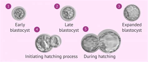 Blastocyst Expansion Rates