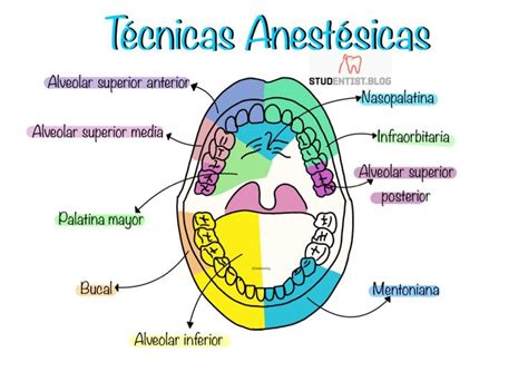 Técnicas anestésicas Odontología Restauración dental Cirugía dental