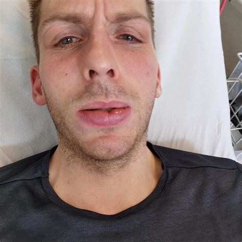 261 best r/allergies images on Pholder | With dust allergies, you get