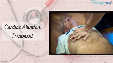 Cardiac Ablation Treatment Cost In India Treatment Procedure