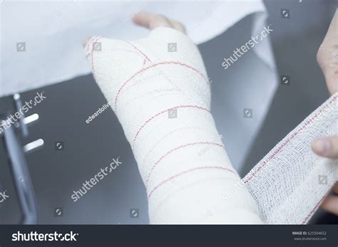 Doctor Applying Plaster Cast Bandages Patient Stock Photo 625504652