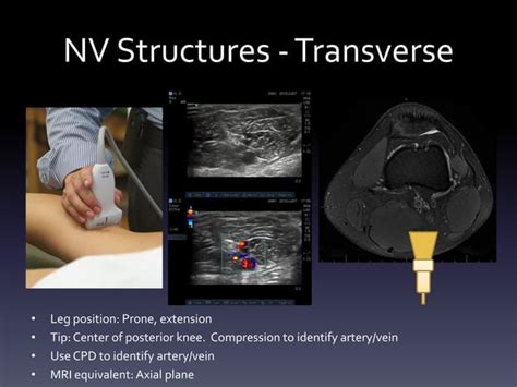 Ultrasound - Knee