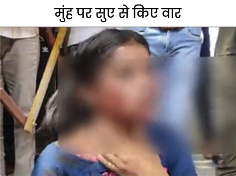 Hisar Youth Attack Girl Camry Road Police Caught Civil Hospital Hisar हिसार में प्रेमिका पर