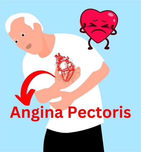 Angina Pectoris About Causes Symptoms Types Test And Treatment