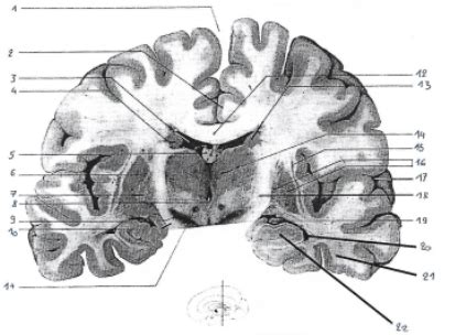 Coupe frontale de l encéphale Diagram Quizlet