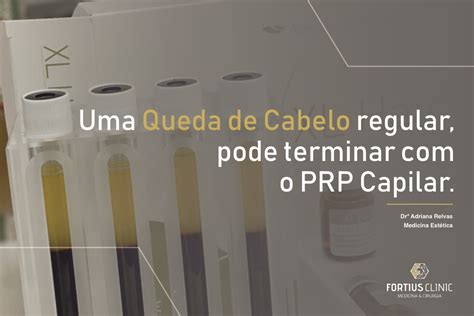 Elimine a Queda do Cabelo PRP Capilar Fortius Fortius Clinic Estética