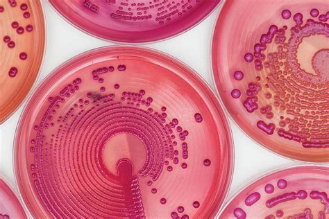 Bacteria Cultures In Macconkey Agar Photograph By Daniela Beckmann