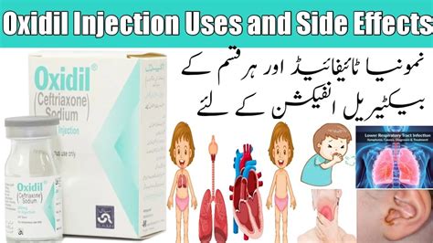 Oxidil Injection Mg Uses And Side Effects In Urdu Hindi