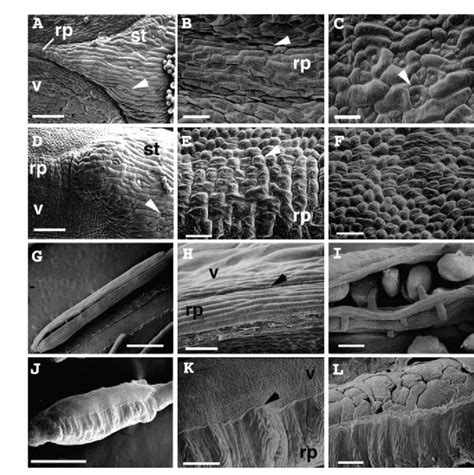 Scanning Electron Micrograph Of Wild Type A C G I And Ful D F