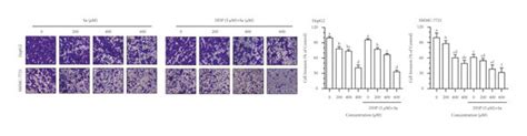 Saddp Inhibits The Migration Of The Hepg2 And Smmc 7721 Cells A The