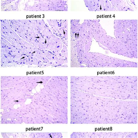 Representative Photomicrographs Showing Von Kossa Staining Of Download Scientific Diagram