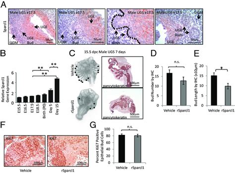 Sparcl1 Inhibits Androgen Induced Fetal Prostate Bud Elongation A Download Scientific