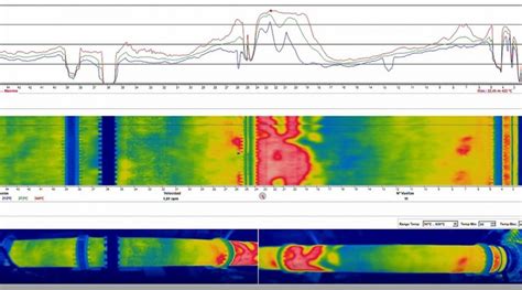 RKS300 Rotary Kiln Monitoring Archivos VisionTIR