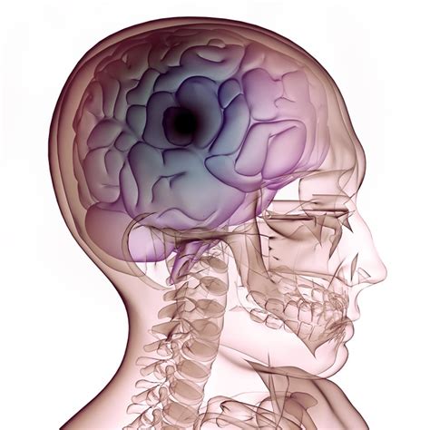 Stem Cell Therapy for Brain Injury | Stemaid Institute