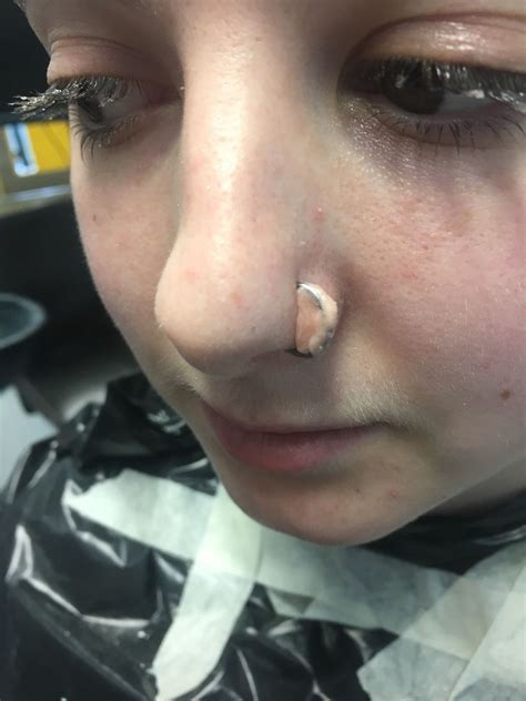 Nose Piercing Close Up Scar