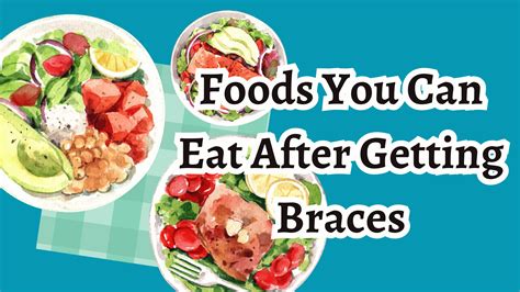 Foods You Can Eat After Getting Braces Healthnord