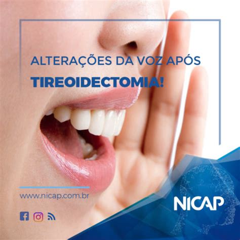 Alterações da Voz Após Tireoidectomia NICAP