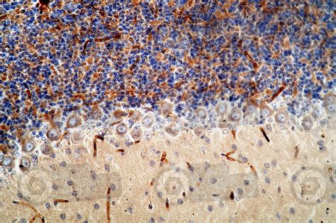 Mammal Cerebellum Sagittal Section 250X Cerebellum Mammals