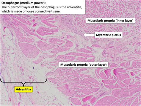 Oesophagus Normal Histology Nus Pathweb Nus Pathweb