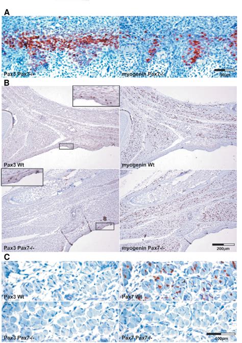 Comparison Of Pax3 Expression In Muscles Of Pax7 And Wild Type Mice