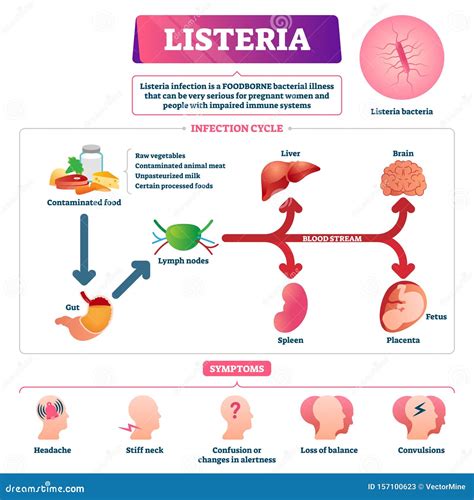 Listeria Vector Illustration. Labeled Educational Foodborne Bacteria ...