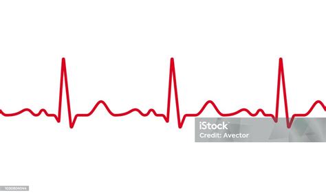 Medische Ecg Of Ekg Pulse Elektrocardiogram Vector Hartslag Rode Lijn