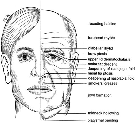 Foundation Volume 2 Chapter 1 Eyebrows Eyelids And Face Structure