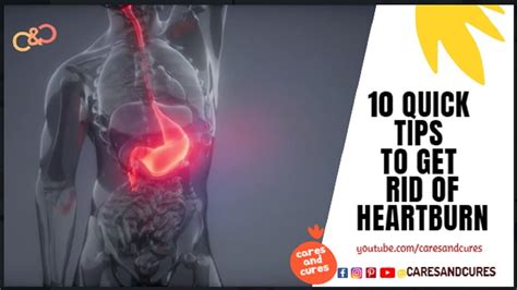 How To Get Rid Of Acid Reflux In Throat Fast Acid Reflux Symptoms