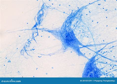 Motor Neuron Microscope