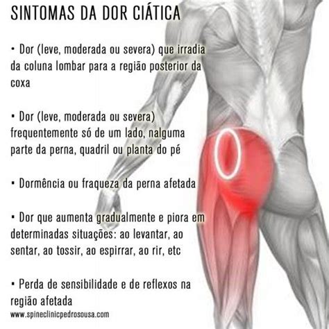 Sintomas Da Dor Ciática Spine Clinic Dor No Nervo Dor Ciática