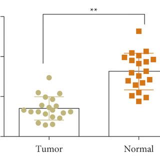 Low Expression Of ZNF667 AS1 In Gastric Cancer Biopsies A And Cell