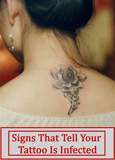 7 Signs That Tell Your Tattoo Is Infected Natural Home Remedies And Supplements