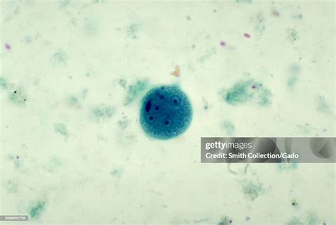 This Photomicrograph Depicted A Mature Entamoeba Coli Cyst News Photo Getty Images