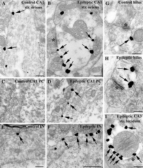 Electron Micrographs Show Preembedding Immunogold Labelling Of Kcc2 In