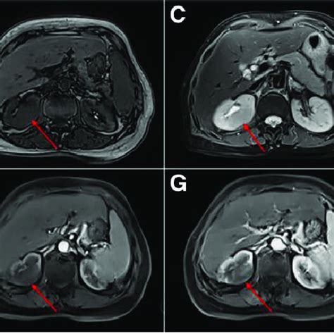 Magnetic Resonance Imaging Mri Slice Thickness 65 Mm A In Phase Download Scientific