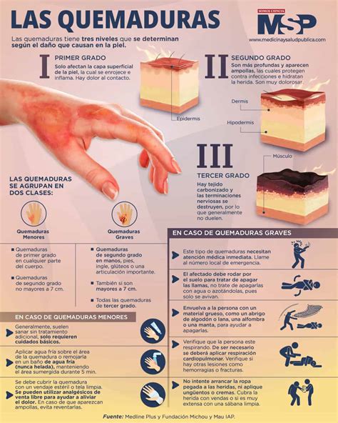 Tratamiento De Lesiones Por Quemaduras De Piel Primeros Auxilios Para