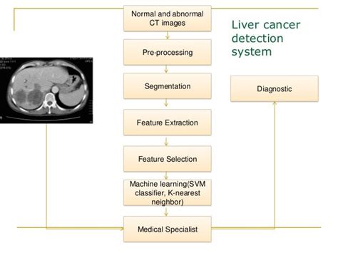 Liver Cancer Detection Using Ctmri Images