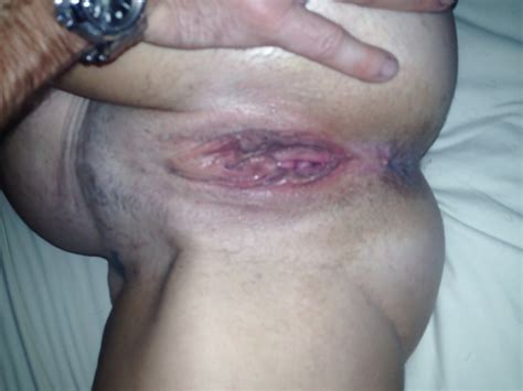Mature Wife Wide Open Pussy Porn Pictures XXX Photos Sex Images PICTOA