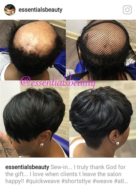 42+ Getting a haircut with alopecia trends | cutehaircuts