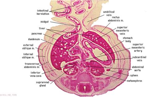 BGDA Practical Placenta Cord Development Embryology