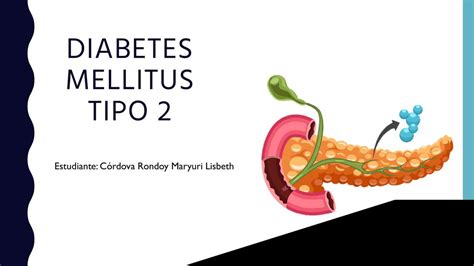 Diabetes Mellitus Tipo 2 Maryuri Lisbeth Udocz