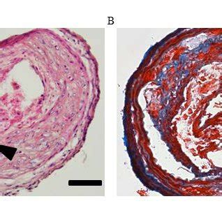 Figure S1. Representative histology of plaque rupture in the newly ...