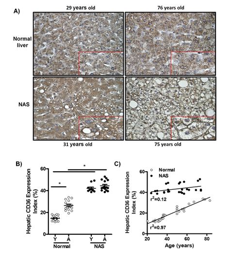 Increased Hepatic CD36 Expression With Age Is Associated With Enhanced